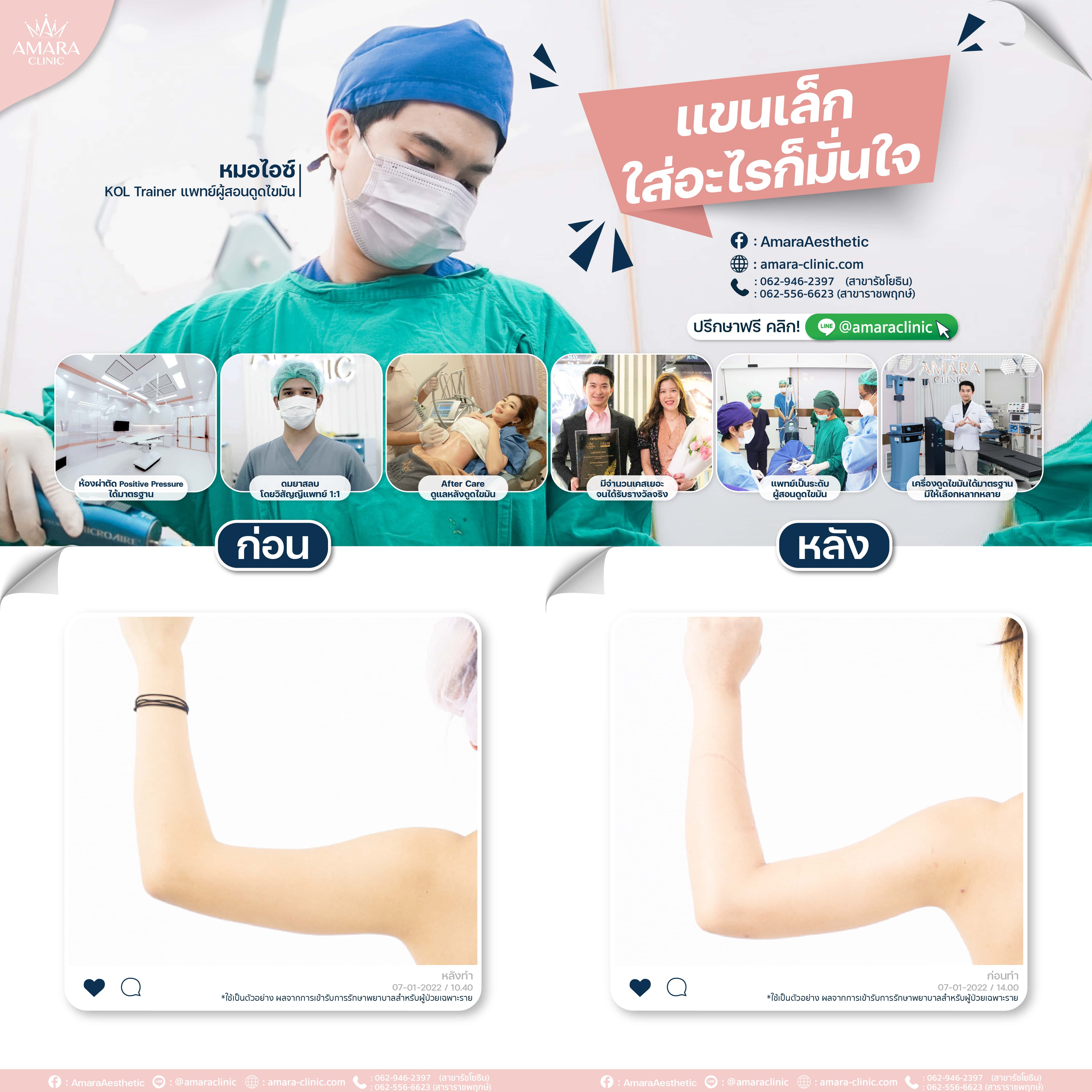 20220830-Aware-Album-BA Album 4076 -04