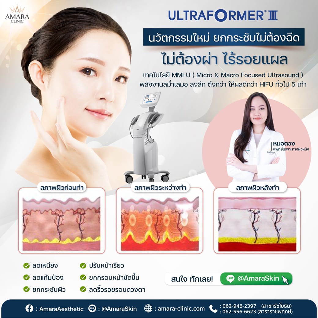 20221214-Aware-Single-MMFUaware-01