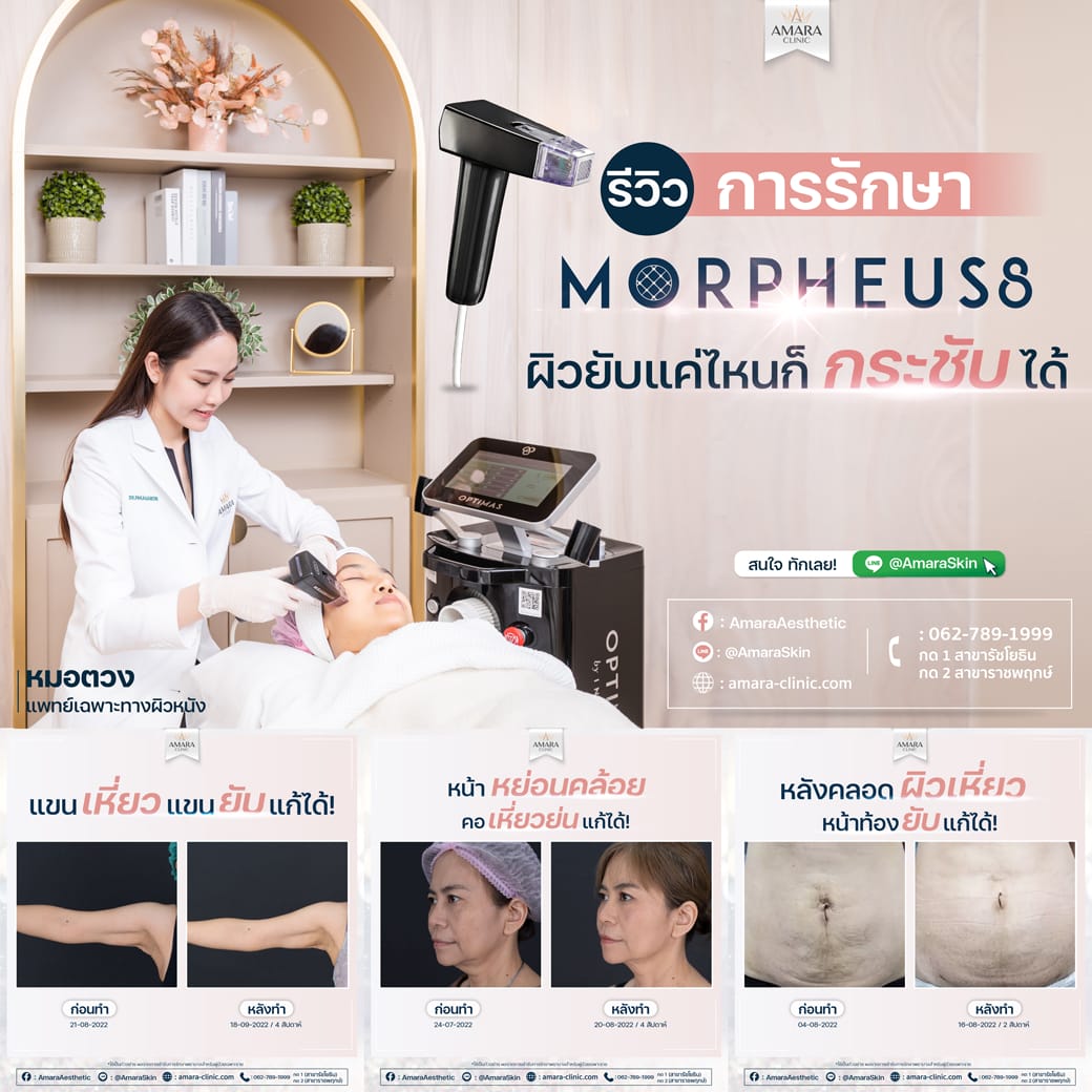 20230427-Aware-Album-MP8 -07