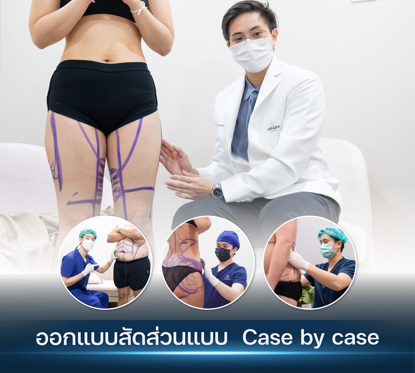 20230503-Line Card-Album-2023-04-13 Balloon 3 card selling point-08