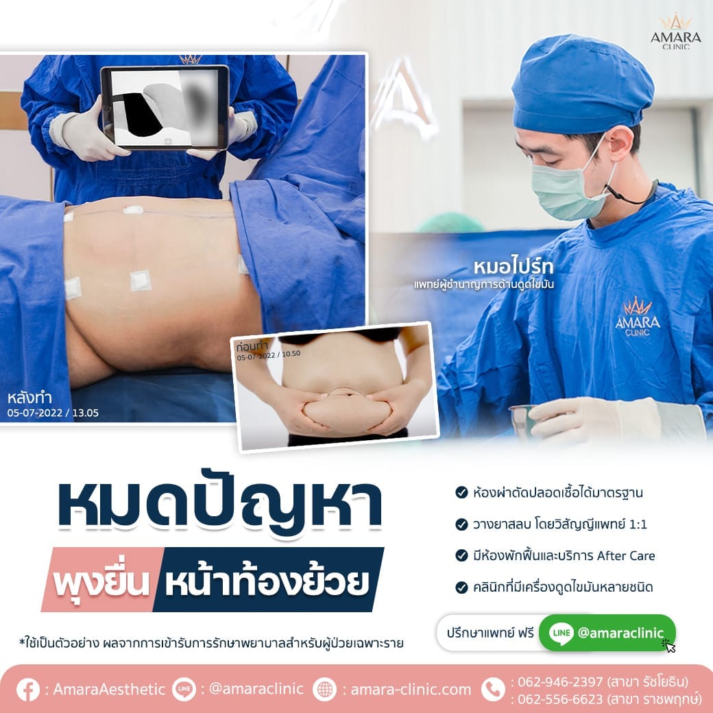 temp-20220726-Aware-1