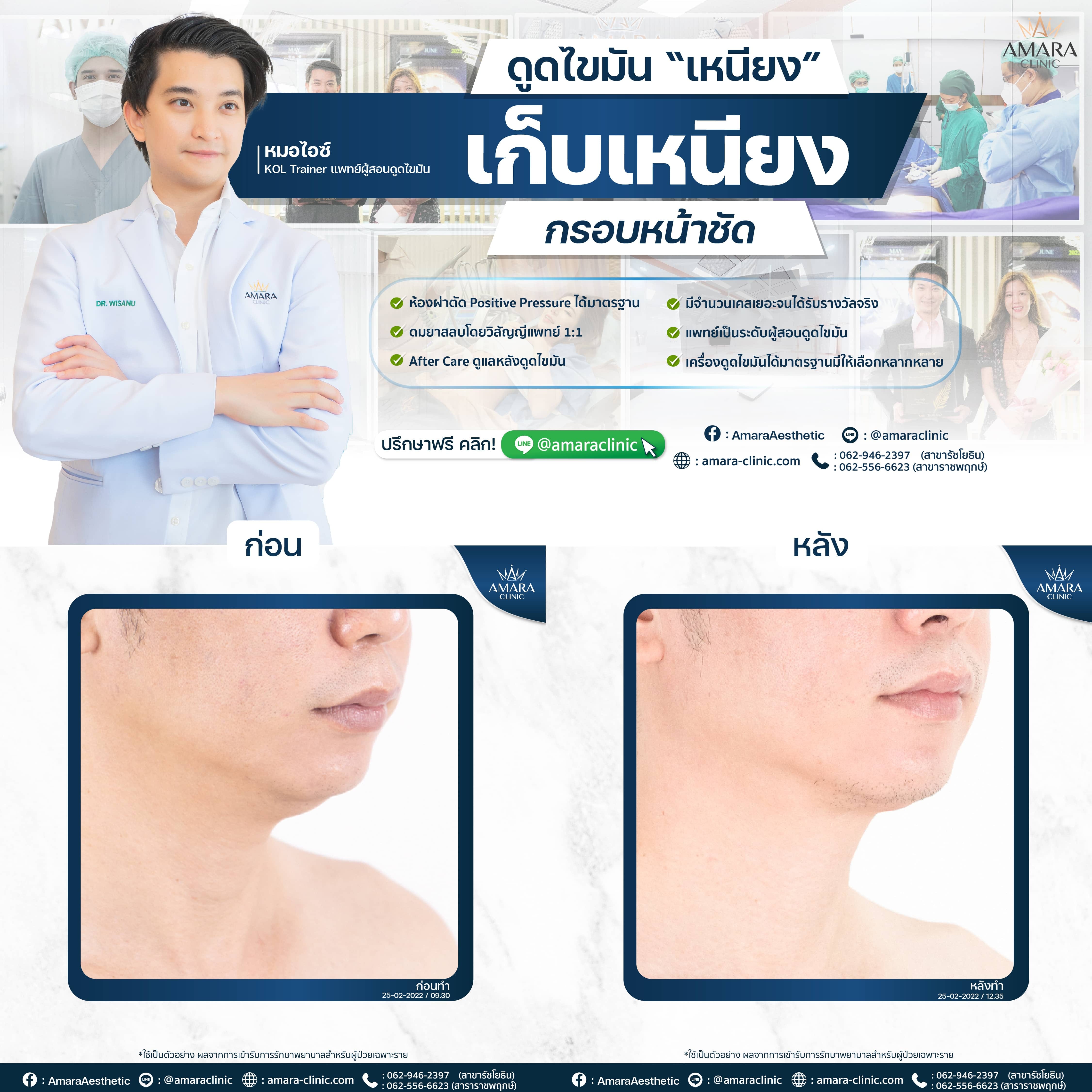 temp-20220825-Aware-BA-Album 7244 -04