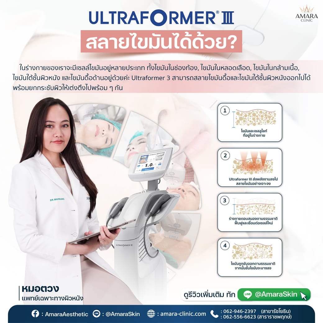 temp-20221127-Consi-Single-MMFU Consi -01