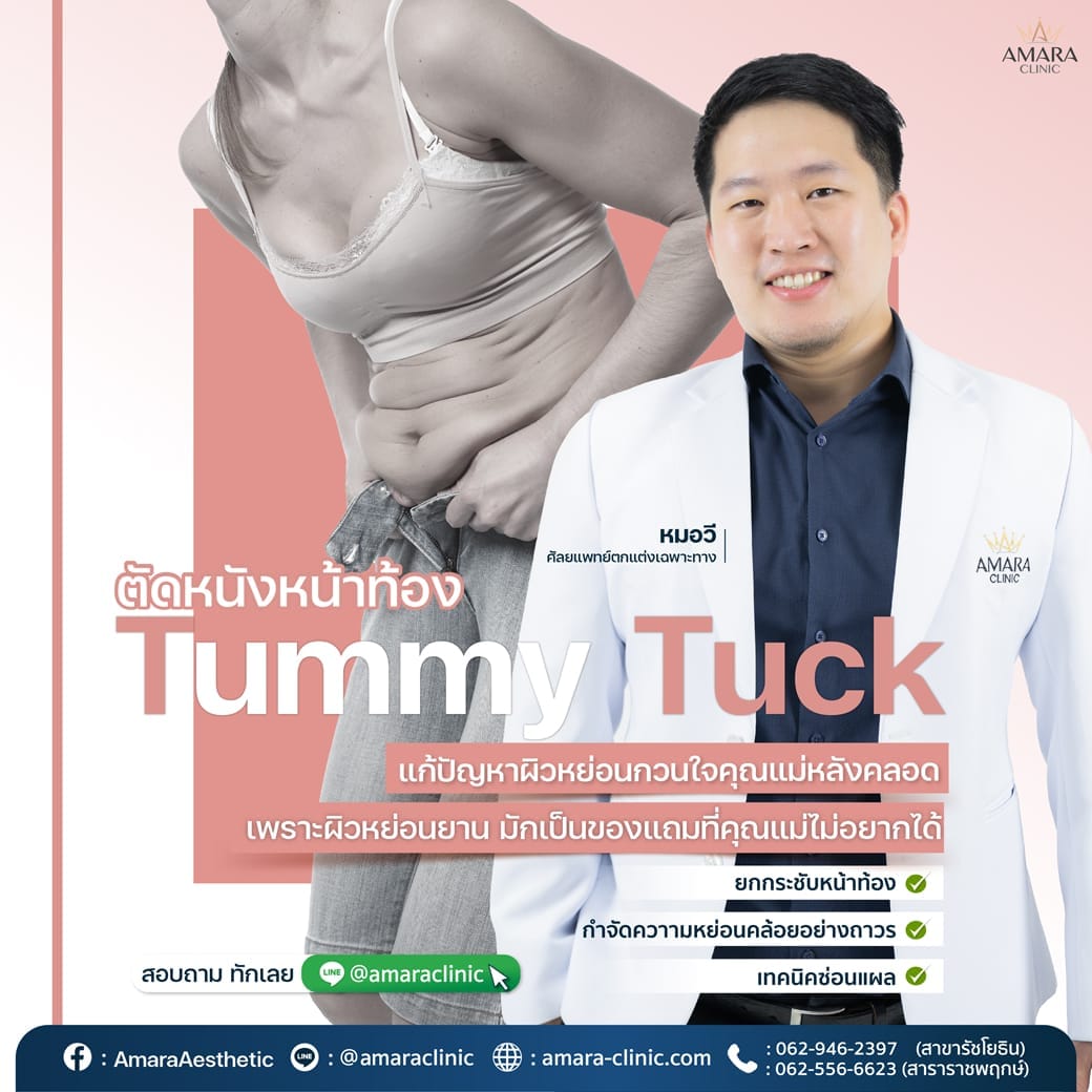 temp-20221206-Aware-Single-aware tummy tuck-01