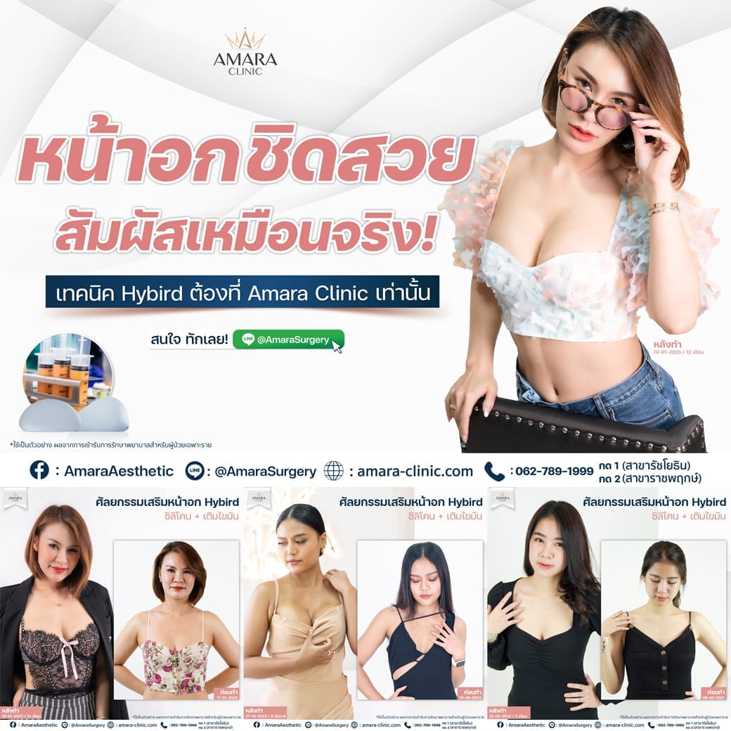 temp-20230218-Aware-Album- -05