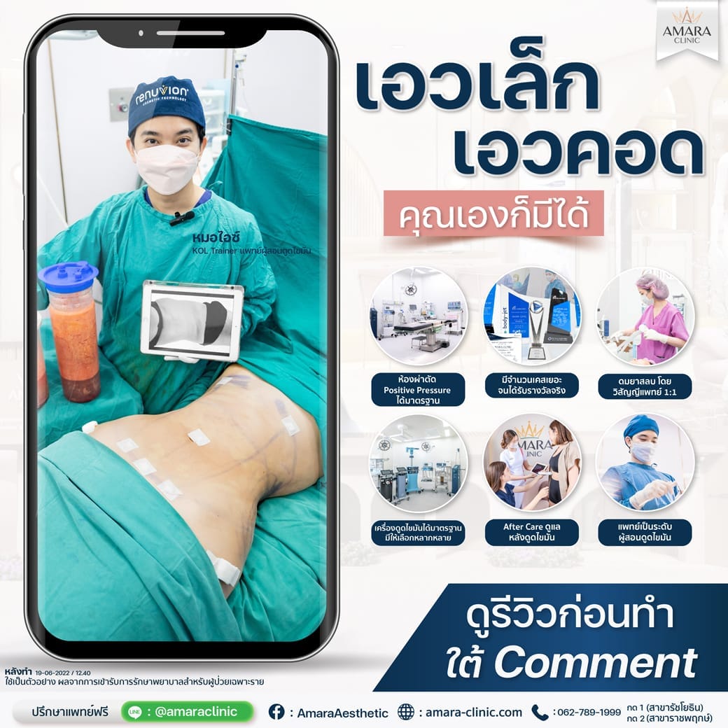 temp-20230510-Aware-Album-BA Checklist 4328-01