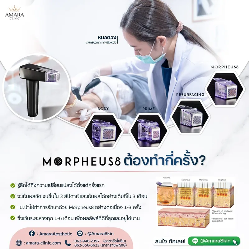 20230111-Consi-Single-MP8 Consi Morpheus8 -01