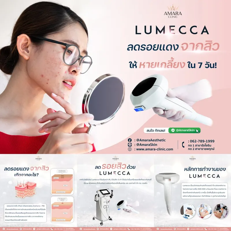 20230403-Consi-Album-Lumecca 7 -06